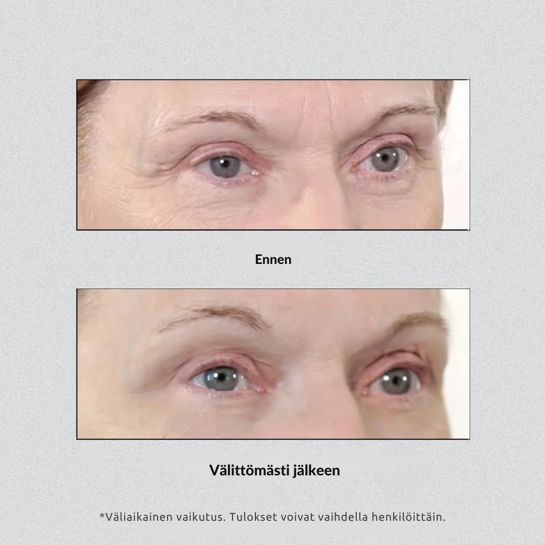 SilmäNosto™ – Välitön kohotus väsyneelle katseelle